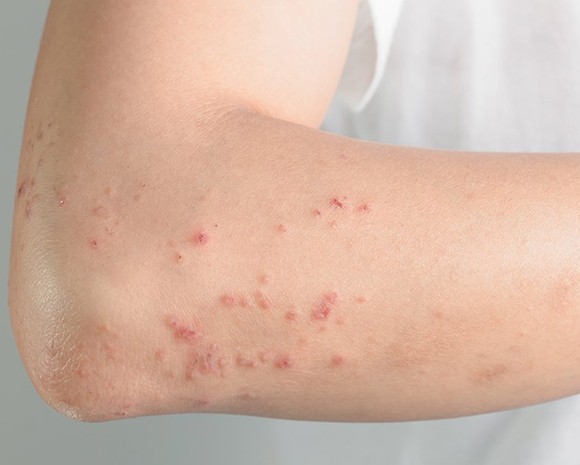 Chia sẻ kinh nghiệm cách thức vệ sinh, chăm sóc giặt giày, áo quần hữu ích
