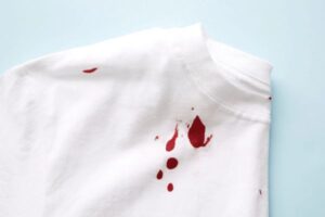 Tẩy vết máu trên vải - Nguyên nhân gây nên những vết máu trên vải